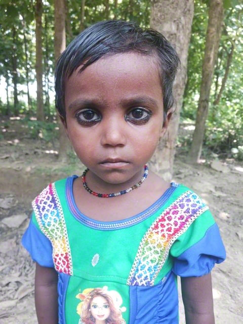 World Vision India